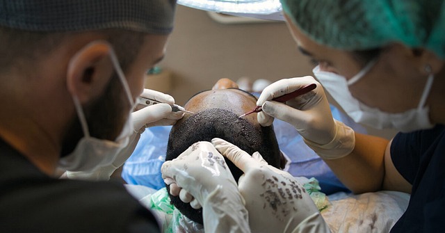 Fra glat til fyldig: En guide til hårtransplantationer for mænd